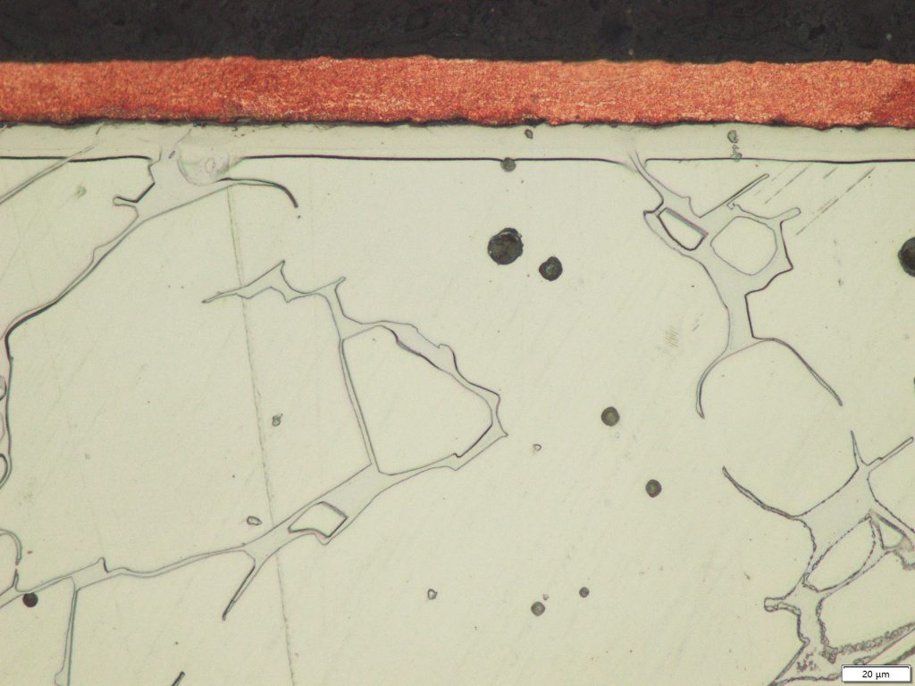 Microstructure of a pump housing made of cast 316L stainless steel and undergone a low-temperature nitriding (S-phase) treatment to improve wear resistance.